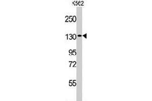 Western blot analysis of VARS polyclonal antibody  in K-562 cell line lysates (35 ug/lane). (VARS Antikörper  (N-Term))