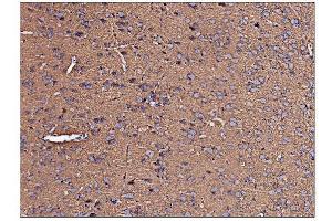 anti-Arginine Decarboxylase (ADC) (AA 1-448) antibody