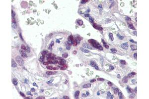 Anti-MORF4L1 / MRG15 antibody IHC of human placenta. (MORF4L1 Antikörper  (AA 2-14))