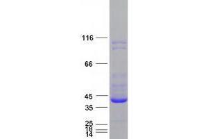 Western Blotting (WB) image for Ubiquitin Carboxyl-terminal Hydrolase L5 (UCHL5) protein (Myc-DYKDDDDK Tag) (ABIN2734949)
