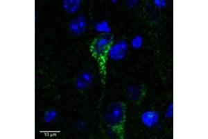 Immunofluorescence (IF) image for anti-Claudin 4 (CLDN4) (C-Term) antibody (ABIN2156608) (Claudin 4 Antikörper  (C-Term))