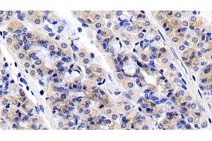 Immunohistochemistry (IHC) image for anti-Ribosomal Protein S6 Kinase, 70kDa, Polypeptide 1 (RPS6KB1) (AA 91-352) antibody (ABIN7430135)