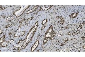 IHC analysis of U2AF65/U2AF2 using anti U2AF65/U2AF2 antibody (ABIN7600795).