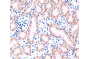 Used in DAB staining on fromalin fixed paraffin- embedded kidney tissue (TRAPPC10 Antikörper  (AA 1077-1259))