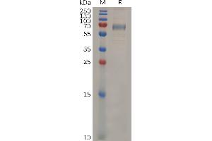 SDS-PAGE (SDS) image for CD33 (CD33) (AA 18-240) protein (Fc Tag) (ABIN7092860)
