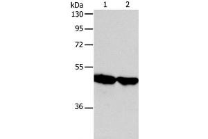 Western Blot analysis of Human fetal liver and liver cancer tissue using AADAC Polyclonal Antibody at dilution of 1:600 (AADAC Antikörper)