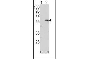 Image no. 1 for anti-Matrix Metallopeptidase 13 (Collagenase 3) (MMP13) (C-Term) antibody (ABIN358686) (MMP13 Antikörper  (C-Term))
