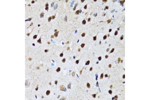 Immunohistochemistry of paraffin-embedded rat brain using CCAR2 antibody (ABIN5974285) at dilution of 1/100 (40x lens).