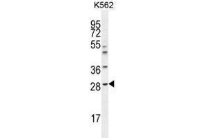 APCS Antibody (C-term) western blot analysis in K562 cell line lysates (35µg/lane).
