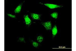 Immunofluorescence of monoclonal antibody to UCKL1 on NIH/3T3 cell. (UCKL1 Antikörper  (AA 301-400))