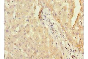 Immunohistochemistry of paraffin-embedded human liver tissue using ABIN7166660 at dilution of 1:100 (DHX3 (AA 694-1000) Antikörper)