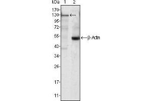 Western blot analysis using JAK3 mouse mAb against Jurkat cell lysate (1). (JAK3 Antikörper)