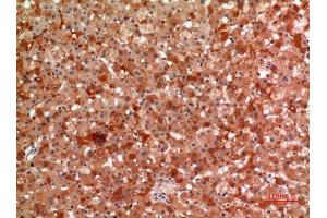 Immunohistochemistry (IHC) analysis of paraffin-embedded Human Liver, antibody was diluted at 1:100. (alpha 2 Macroglobulin Antikörper  (Internal Region))