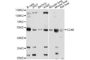 Western blot analysis of extracts of various cell lines, using CD40 Antibody.
