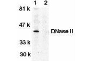 Western Blotting (WB) image for anti-Deoxyribonuclease II, Lysosomal (DNASE2) (C-Term) antibody (ABIN2473351) (DNASE2 Antikörper  (C-Term))