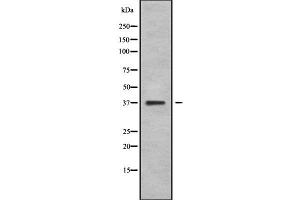 Western blot analysis NEUROD4 using COLO205 whole cell lysates (NEUROD4 Antikörper  (N-Term))