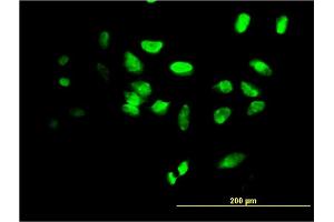 Immunofluorescence of monoclonal antibody to FOXF2 on HeLa cell. (FOXF2 Antikörper  (AA 346-443))