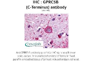 Image no. 1 for anti-G Protein-Coupled Receptor, Family C, Group 5, Member B (GPRC5B) (C-Term) antibody (ABIN1735212) (GPRC5B Antikörper  (C-Term))