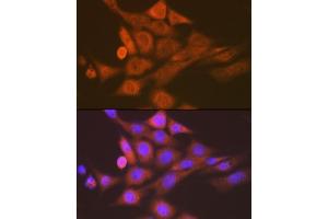 Immunofluorescence analysis of NIH-3T3 cells using SKP1 Rabbit mAb (ABIN7270120) at dilution of 1:100 (40x lens).