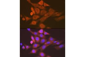 Immunofluorescence analysis of NIH-3T3 cells using SKP1 Rabbit mAb (ABIN7270120) at dilution of 1:100 (40x lens). (SKP1 Antikörper)