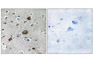 Immunohistochemistry analysis of paraffin-embedded human brain tissue using AKAP1 antibody. (AKAP1 Antikörper  (Internal Region))