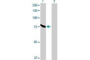 Western Blotting (WB) image for MAN1C1 293T Cell Transient Overexpression Lysate(Denatured) (ABIN1337186)