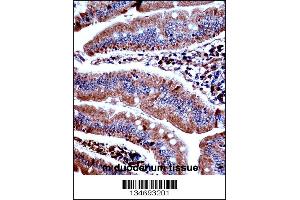 Mouse Prkd3 Antibody immunohistochemistry analysis in formalin fixed and paraffin embedded mouse duodenum tissue followed by peroxidase conjugation of the secondary antibody and DAB staining. (PRKD3 Antikörper  (N-Term))