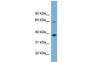 SNX7 antibody used at 1 ug/ml to detect target protein. (Sorting Nexin 7 Antikörper  (Middle Region))