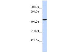 Human Heart; WB Suggested Anti-ACOT2 Antibody Titration: 0. (ACOT2 Antikörper  (Middle Region))