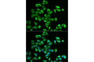 Immunofluorescence analysis of A549 cells using POMGNT2 antibody (ABIN2562968).