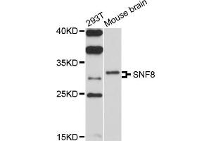 Western blot analysis of extracts of various cell lines, using SNF8 antibody (ABIN4905253) at 1:1000 dilution. (SNF8 Antikörper)