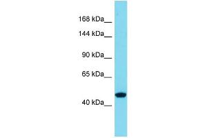 Host:  Rabbit  Target Name:  SLC39A10  Sample Type:  Thyroid Tumor lysates  Antibody Dilution:  1. (SLC39A10 Antikörper  (N-Term))