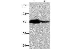 Western blot analysis of Human ovarian cancer and mouse heart tissue, using CBX2 Polyclonal Antibody at dilution of 1:350 (CBX2 Antikörper)