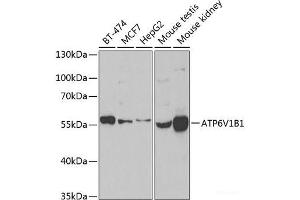 Western blot analysis of extracts of various cell lines using ATP6V1B1 Polyclonal Antibody at dilution of 1:1000. (ATP6V1B1 Antikörper)