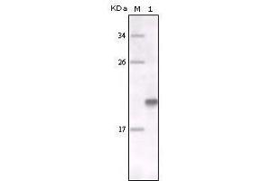 Western Blot showing MER antibody used against full-length MER recombinant protein. (MERTK Antikörper)