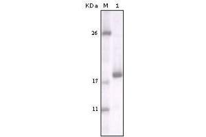 Western blot analysis using DDR2 mouse mAb against truncated DDR2 recombinant protein. (DDR2 Antikörper)