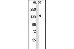 Western blot analysis of LY75 Antibody (Center) (ABIN652943 and ABIN2842602) in HL-60 cell line lysates (35 μg/lane). (LY75/DEC-205 Antikörper  (AA 646-675))