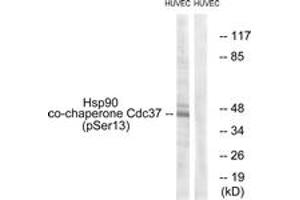Western blot analysis of extracts from HuvEc cells, using CDC37 (Phospho-Ser13) Antibody.