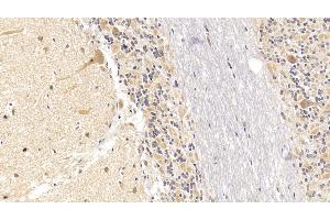 Detection of SEMA5B in Human Cerebellum Tissue using Monoclonal Antibody to Semaphorin 5B (SEMA5B) (SEMA5B Antikörper  (AA 350-602))