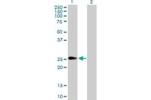 Western Blot analysis of PIP5K1C expression in transfected 293T cell line by PIP5K1C MaxPab polyclonal antibody.