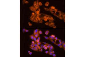 Immunofluorescence analysis of HepG2 cells using N Rabbit mAb (ABIN7268773) at dilution of 1:200 (40x lens). (NAT1 Antikörper)