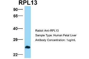 Host:  Rabbit  Target Name:  RPL13  Sample Type:  Human Fetal Liver  Antibody Dilution:  1.