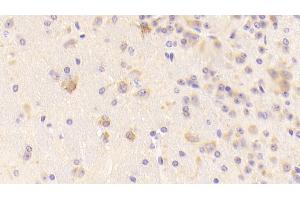 Detection of TFR in Mouse Cerebrum Tissue using Polyclonal Antibody to Transferrin Receptor (TFR) (Transferrin Receptor Antikörper  (AA 572-757))