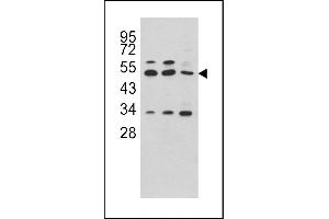 Western blot analysis of C antibody (C-term) (ABIN391510 and ABIN2841472) in Hela, CEM and NCI- cell line lysates (35 μg/lane).