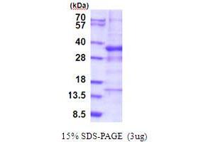 SDS-PAGE (SDS) image for General Transcription Factor IIIC, Polypeptide 6, alpha 35kDa (GTF3C6) (AA 1-213) protein (His tag) (ABIN5853974)