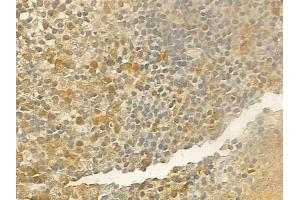 ABIN6257284 and ABIN6274172 at 1/100 staining human normal tonsil tissue by IHC-P. (IRF2 Antikörper  (Internal Region))