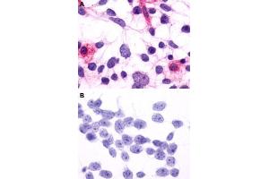 Immunocytochemistry (ICC) staining of HEK293 human embryonic kidney cells transfected (A) or untransfected (B) with RHO. (Rho-related GTP-binding protein Antikörper  (2nd Extracellular Domain))