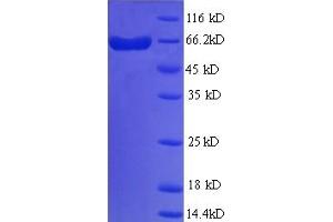 SDS-PAGE (SDS) image for Lectin, Galactoside-Binding, Soluble, 9 (LGALS9) (AA 1-323) protein (His-GST) (ABIN5709851) (Galectin 9 Protein (AA 1-323) (His-GST))