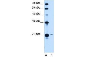 TCP10L antibody used at 1. (TCP10L Antikörper)