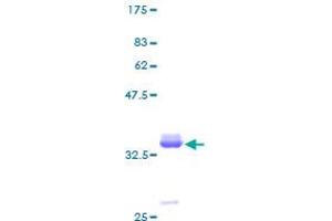 Image no. 1 for Pancreatic Polypeptide (PPY) (AA 1-95) protein (GST tag) (ABIN1316102) (PPY Protein (AA 1-95) (GST tag))